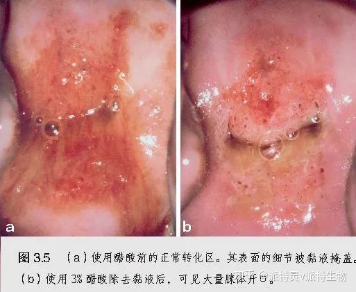 以太坊钱包的币怎么变成现金_tp钱包怎么兑换以太坊_以太坊钱包换手机怎么换过去